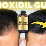How to Use Minoxidil for Hair Regrowth – Tips, Results & Side Effects