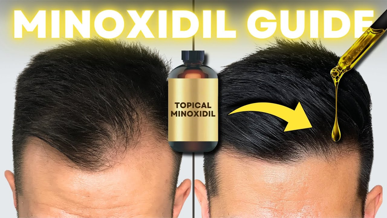 How to Use Minoxidil for Hair Regrowth – Tips, Results & Side Effects